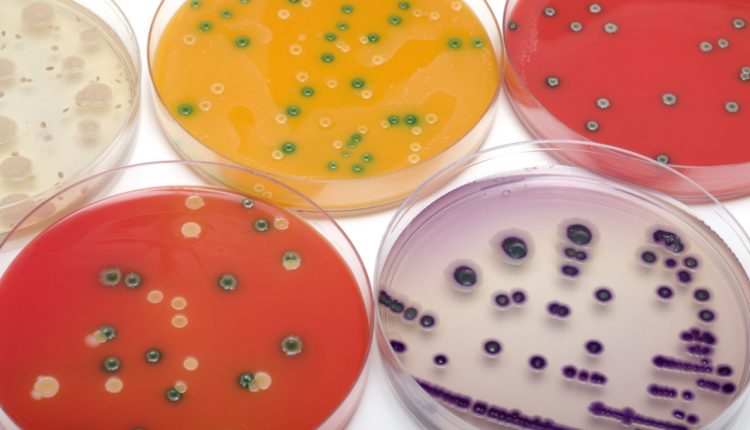 Listeria cases prompt warning in New Zealand