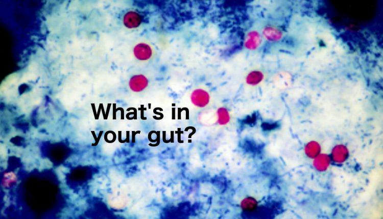 Another Cyclospora outbreak from Fresh Express’s Illinois processing facility
