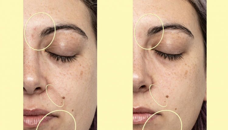 Buff Away Dull Winter Skin With These $3 Brightening Pads
