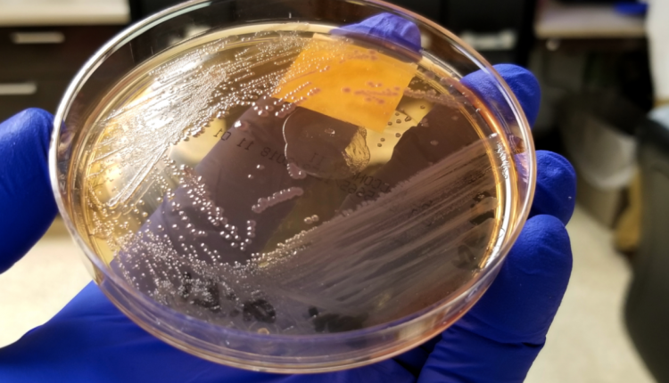 Study shows antimicrobial-resistant strains of Salmonella infections are rising