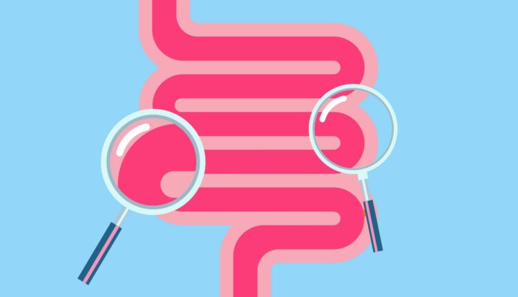 New Colon Cancer Screening Guidelines: What You Need to Know