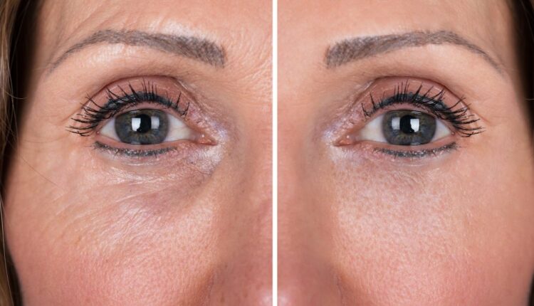 Say Goodbye to Eye Lines With This Peptide-Infused Tightening Gel